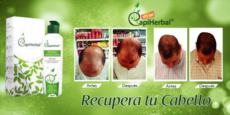 regente de farmacia y profesor dos hombres con caida de cabello ahora son testigos de la recuperación capilar